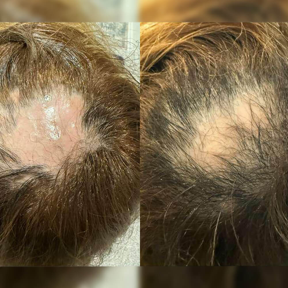 PRP Therapy  A regenerative treatment using your body’s own growth factors to repair and rejuvenate.  View Treatments